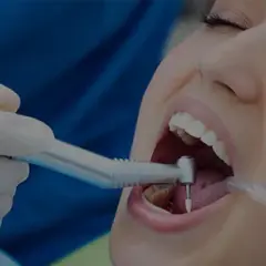 Czego nie jeść po wizycie u dentysty? Unikaj tych produktów, by nie zaszkodzić zębom!