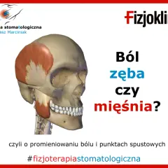 Model czaszki z zaznaczonym mięśniem żwaczem. Czy to ból kości żuchwy przy dotyku, czy problem z mięśniem? #fizjoterapiastomatologiczna