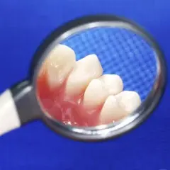 Co na bolące dziąsło od ósemki – skuteczne sposoby na ulgę i kiedy iść do dentysty