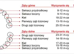 Wyrzynanie zębów jak wygląda: objawy, etapy i sposoby na złagodzenie bólu