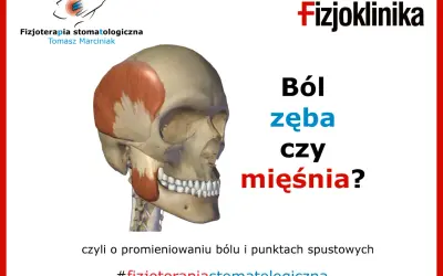Model czaszki z zaznaczonym mięśniem żwaczem. Czy to ból kości żuchwy przy dotyku, czy problem z mięśniem? #fizjoterapiastomatologiczna