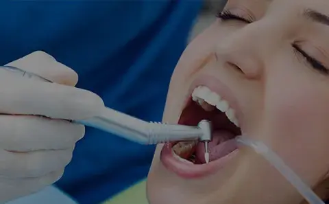 Czego nie jeść po wizycie u dentysty? Unikaj tych produktów, by nie zaszkodzić zębom!
