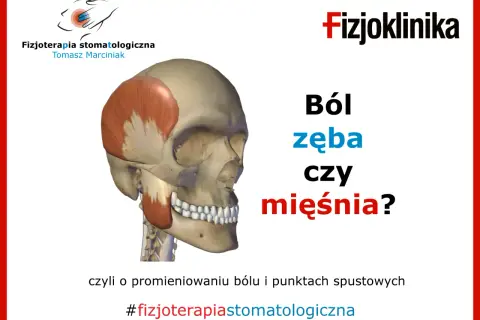 Model czaszki z zaznaczonym mięśniem żwaczem. Czy to ból kości żuchwy przy dotyku, czy problem z mięśniem? #fizjoterapiastomatologiczna
