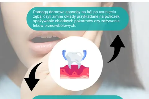 Jak długo boli po usunięciu zęba i jak szybko złagodzić nieprzyjemne dolegliwości