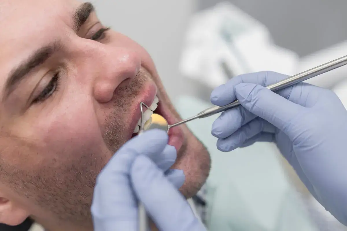 Dentysta bada ukruszony ząb pacjenta za pomocą lusterka i narzędzia.
