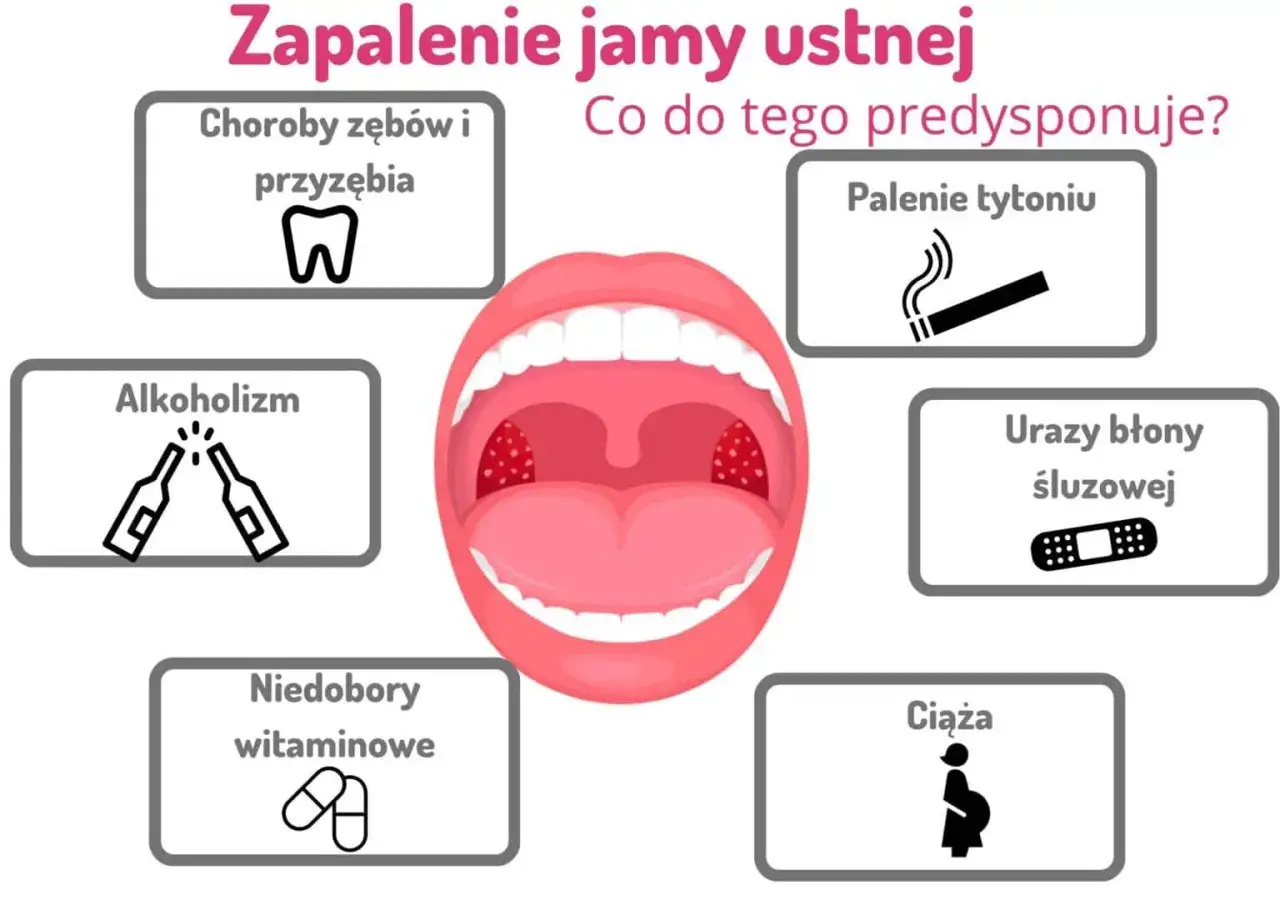 Zdjęcie Objawy zapalenia jamy ustnej: jak rozpoznać i złagodzić ból oraz dyskomfort