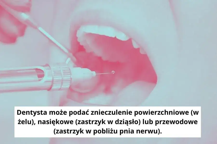 Zdjęcie Skuteczne sposoby na ból dziąseł – jak szybko złagodzić dyskomfort