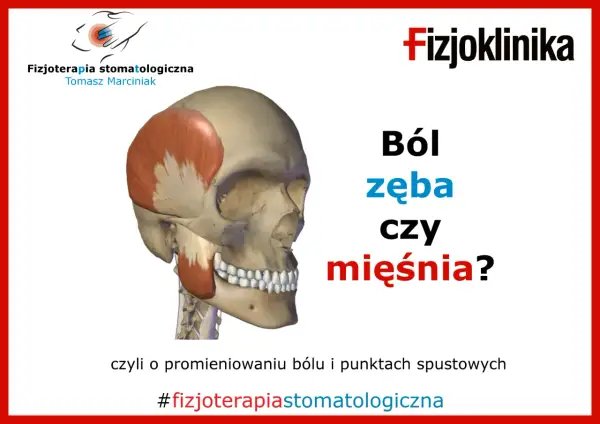 Model czaszki z zaznaczonym mięśniem żwaczem. Czy to ból kości żuchwy przy dotyku, czy problem z mięśniem? #fizjoterapiastomatologiczna