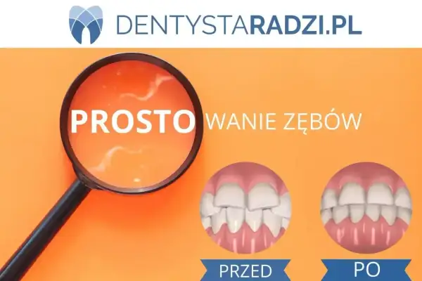 Licówki na krzywe zęby: przed i po. Lupa pokazuje "PROSTO", a obok dwa uśmiechy - jeden z nierównymi zębami, drugi idealny.